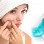 does-toothpaste-get-rid-of-pimples