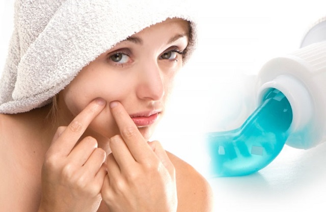 does-toothpaste-get-rid-of-pimples